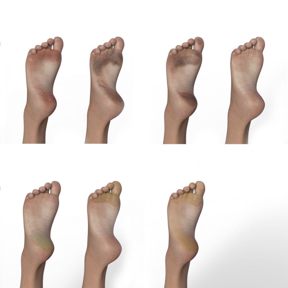 Feet Variations - Texture Alternatives For Genesis 8 Female