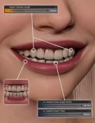 NG Build Your Own Smile for Genesis 9 - Dental Work