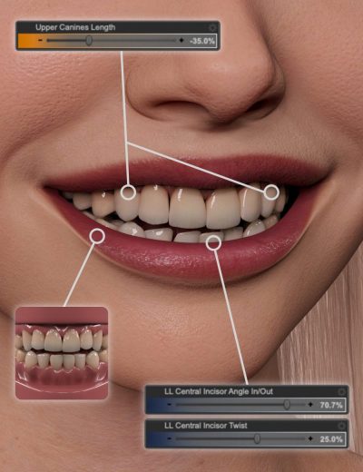 ngbuildyourownsmileforgenesis9dentalwork00maindaz3d-scaled-2